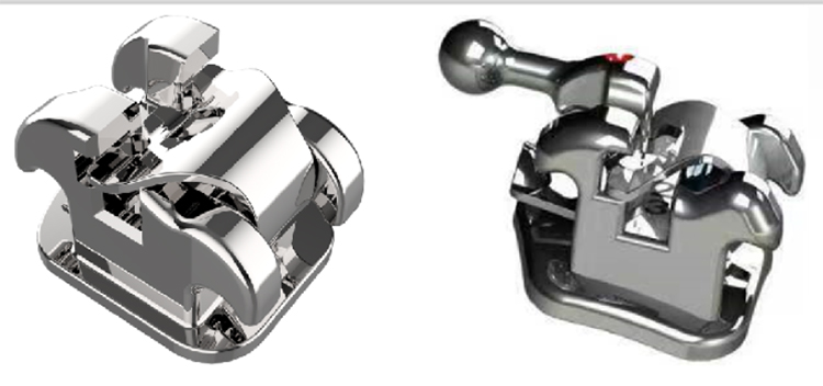 OR1031 Self-ligating Metal Brackets MA2